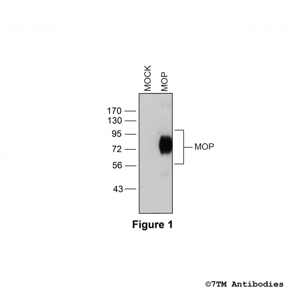 MOP (non-phospho), µ-Opioid Receptor Antibody