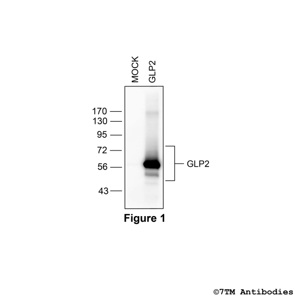 GLP2 (non-phospho) Glucagon-Like Peptide 2 Receptor Antibody