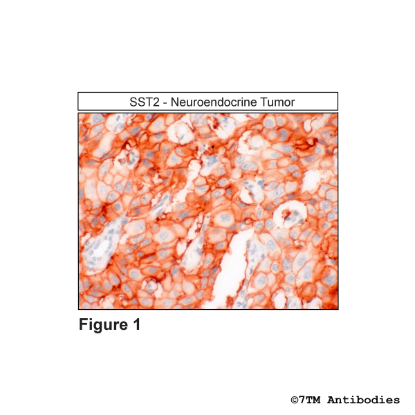 SST2 (IHC-grade), Somatostatin Receptor 2 Antibody