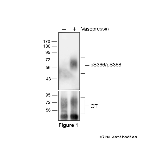Agonist-induced Serine366/Serine368 phosphorylation of the Oxytocin Receptor