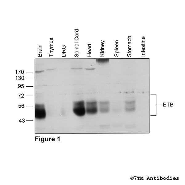 Indentification of the Endothelin Receptor B in mouse tissues.