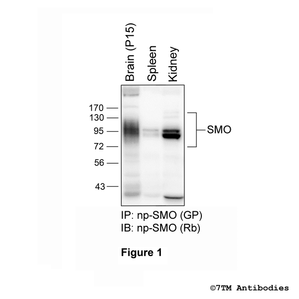 Isolation and enrichment of the Smoothened Receptor from tissue lysates