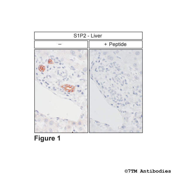 S1P2 (IHC-grade), Sphingosine 1-Phosphate Receptor 2 Antibody