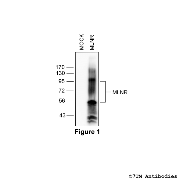MLNR (non-phospho) Motilin Receptor Antibody