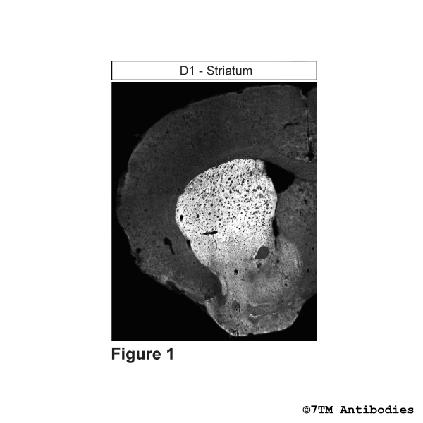 Immunohistochemical identification of Dopamine Receptor 1 in striatum