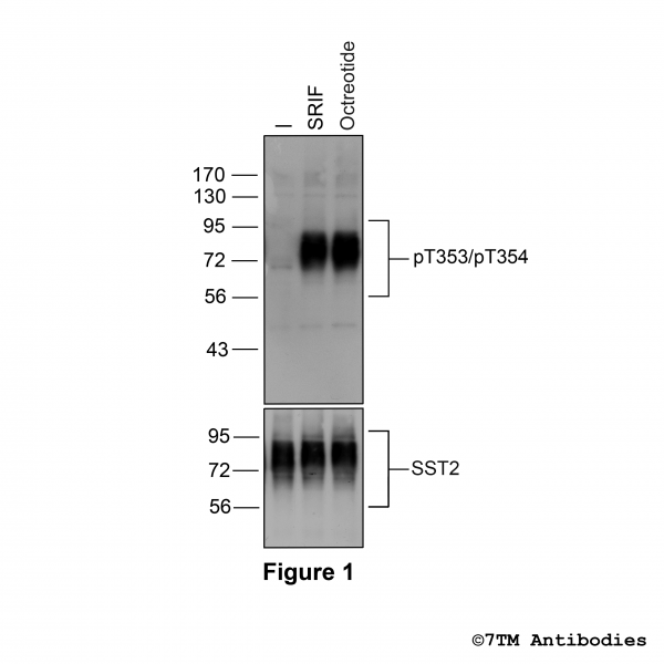 Agonist-induced Threonine353/Threonine354 phosphorylation of the Somatostatin Receptor 2.