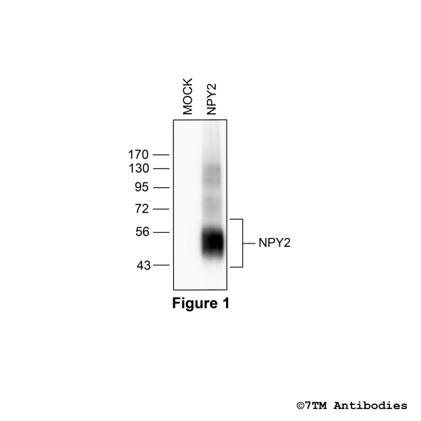 Validation of the Neuropeptide Y Receptor 2 in transfected HEK293 cells