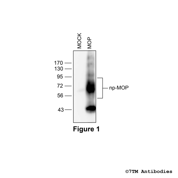 Validation of the µ-Opioid Receptor in transfected HEK293 cells